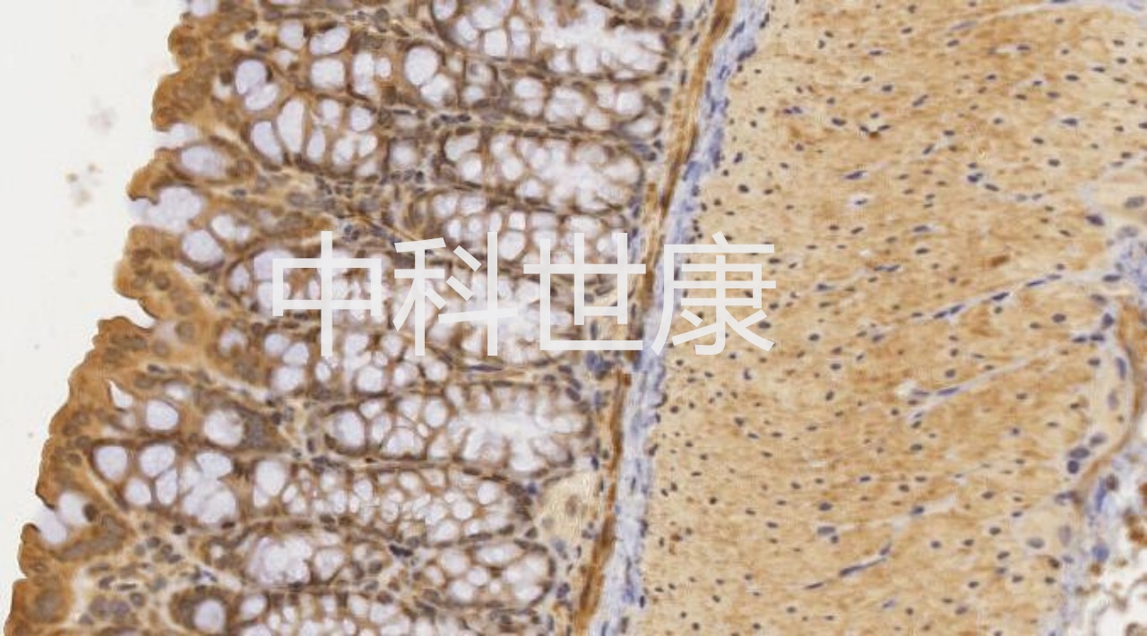 免疫组化IHC的操作方法——南京中科世康生物